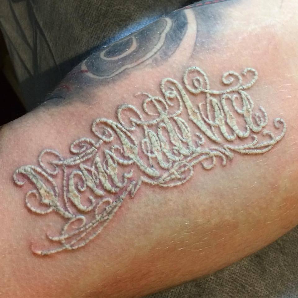 laser tattoo removal clinic west beach the tattoo removal co laser tattoo removal clinic west beach the tattoo removal co