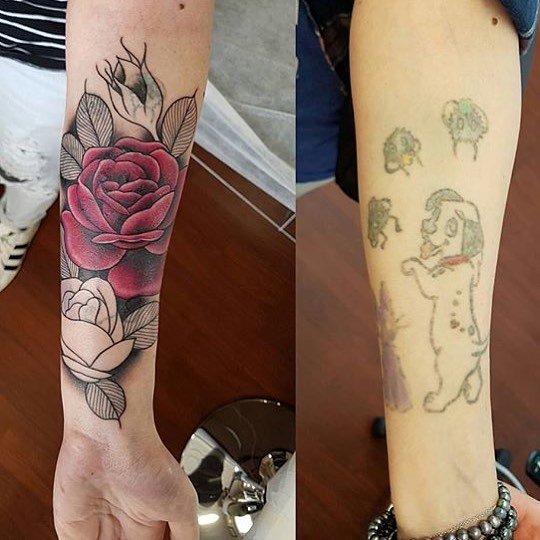 laser tattoo removal clinic hallett cove the tattoo removal co laser tattoo removal clinic hallett cove the tattoo removal co